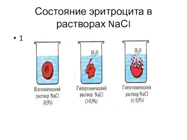 Состояние эритроцита в растворах NаСI 1