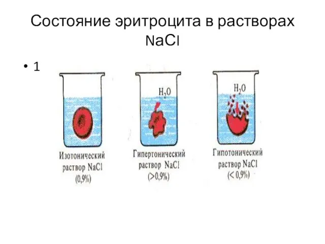 Состояние эритроцита в растворах NаСI 1