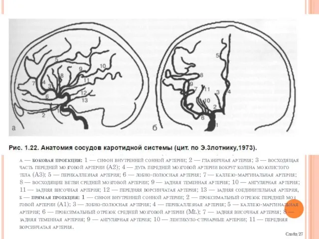 Рис. 1.22. Анатомия сосудов каротидной системы (цит. по Э.3лотнику,1973). а —