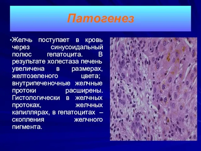Патогенез Желчь поступает в кровь через синусоидальный полюс гепатоцита. В результате