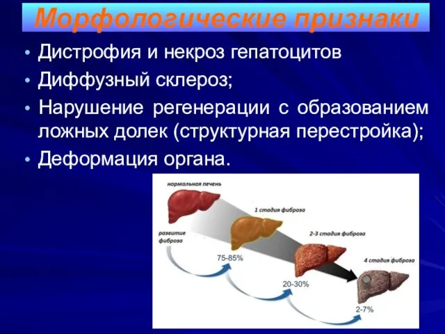 Дистрофия и некроз гепатоцитов Диффузный склероз; Нарушение регенерации с образованием ложных