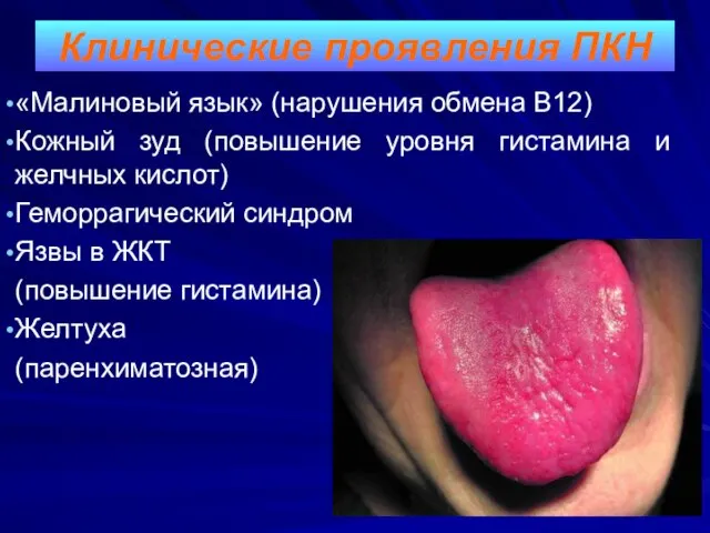 «Малиновый язык» (нарушения обмена В12) Кожный зуд (повышение уровня гистамина и