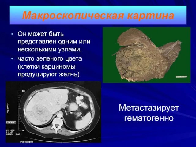 Он может быть представлен одним или несколькими узлами, часто зеленого цвета