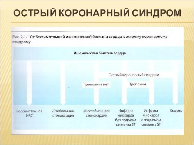 ОСТРЫЙ КОРОНАРНЫЙ СИНДРОМ