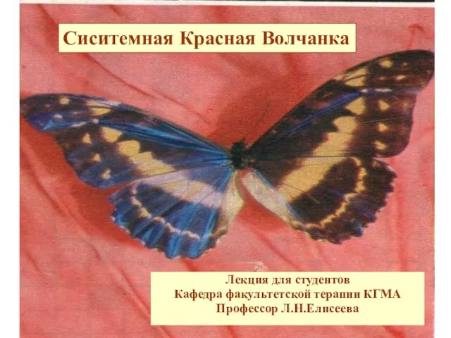 Лекция для студентов Кафедра факультетской терапии КГМА Профессор Л.Н.Елисеева Сиситемная Красная Волчанка