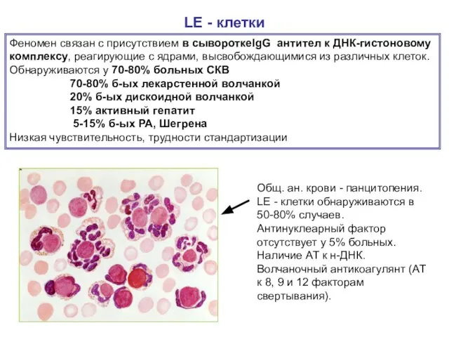 LE - клетки Феномен связан с присутствием в сывороткеIgG антител к