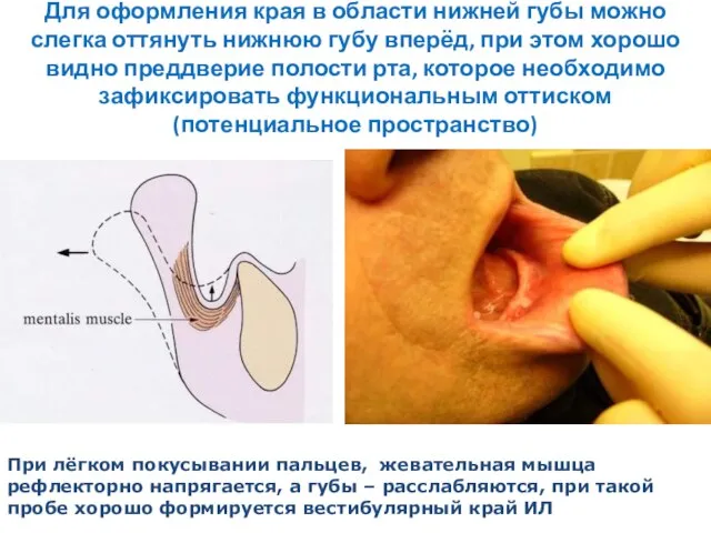 Для оформления края в области нижней губы можно слегка оттянуть нижнюю