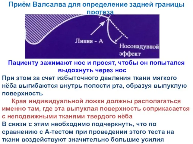 Приём Валсалва для определение задней границы протеза Пациенту зажимают нос и