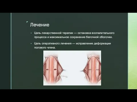 Лечение Цель лекарственной терапии — остановка воспалительного процесса и максимальное сохранение