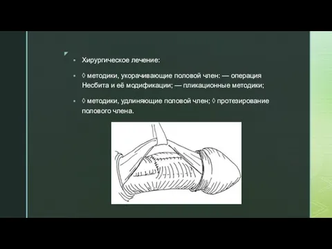 Хирургическое лечение: ◊ методики, укорачивающие половой член: — операция Несбита и