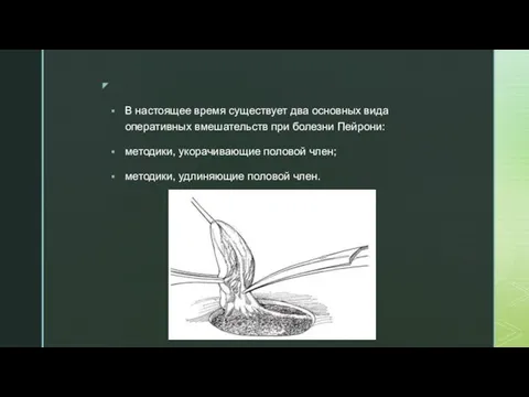 В настоящее время существует два основных вида оперативных вмешательств при болезни