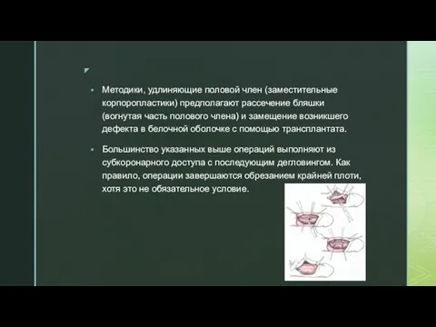 Методики, удлиняющие половой член (заместительные корпоропластики) предполагают рассечение бляшки (вогнутая часть