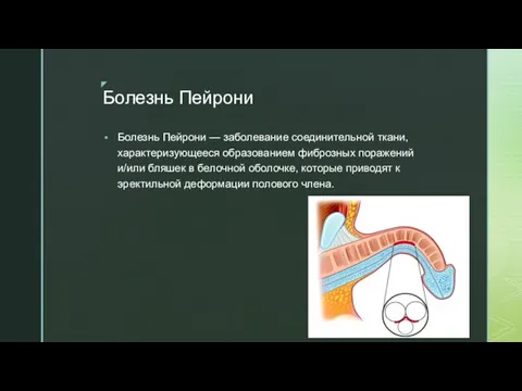 Болезнь Пейрони Болезнь Пейрони — заболевание соединительной ткани, характеризующееся образованием фиброзных