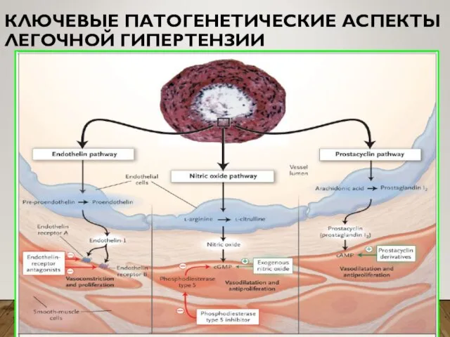 КЛЮЧЕВЫЕ ПАТОГЕНЕТИЧЕСКИЕ АСПЕКТЫ ЛЕГОЧНОЙ ГИПЕРТЕНЗИИ