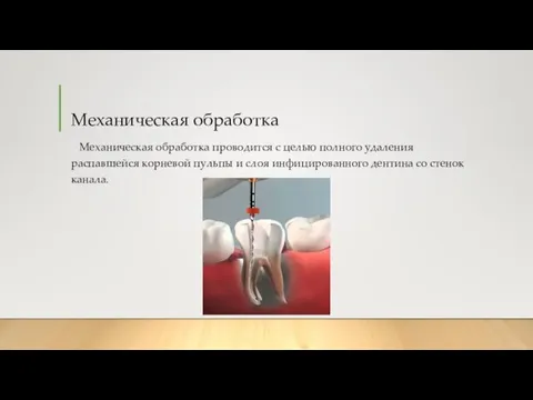 Механическая обработка Механическая обработка проводится с целью полного удаления распавшейся корневой