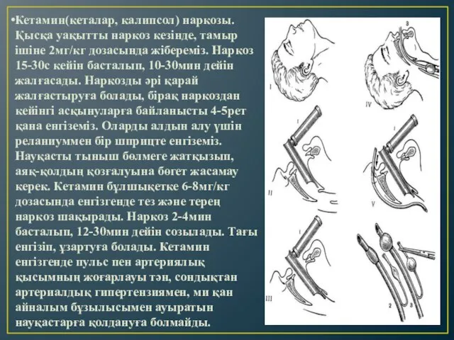 Кетамин(кеталар, калипсол) наркозы. Қысқа уақытты наркоз кезінде, тамыр ішіне 2мг/кг дозасында