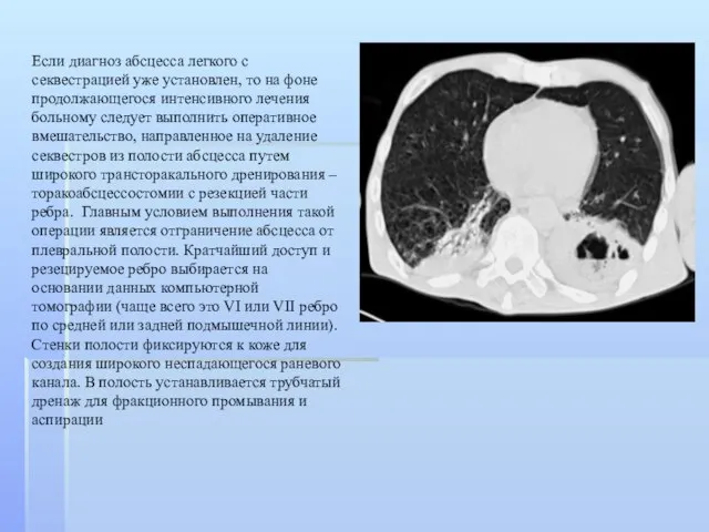 Если диагноз абсцесса легкого с секвестрацией уже установлен, то на фоне