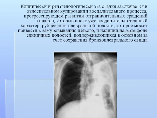 Клинически и рентгенологически эта стадия заключается в относительном купировании воспалительного процесса,