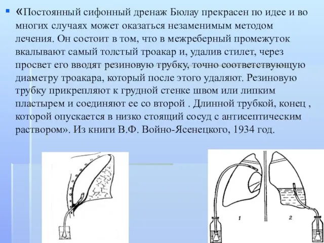 «Постоянный сифонный дренаж Бюлау прекрасен по идее и во многих случаях