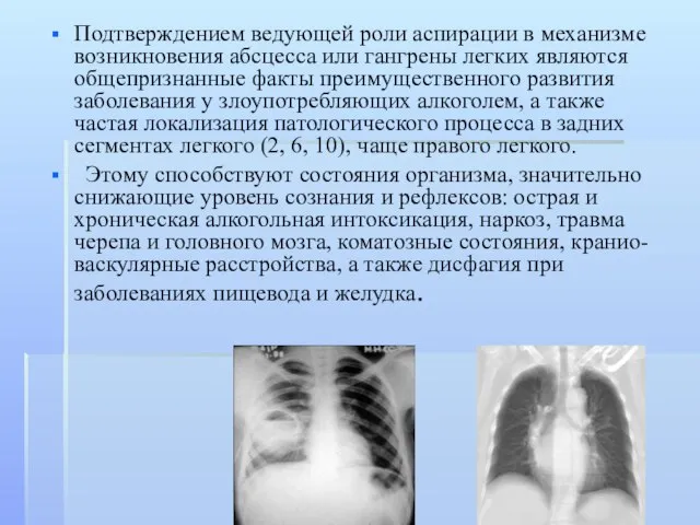 Подтверждением ведующей роли аспирации в механизме возникновения абсцесса или гангрены легких