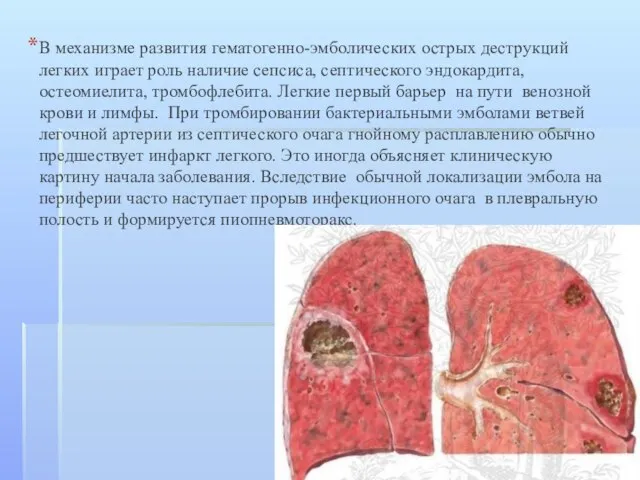 В механизме развития гематогенно-эмболических острых деструкций легких играет роль наличие сепсиса,