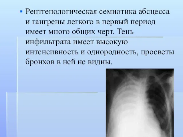 Рентгенологическая семиотика абсцесса и гангрены легкого в первый период имеет много