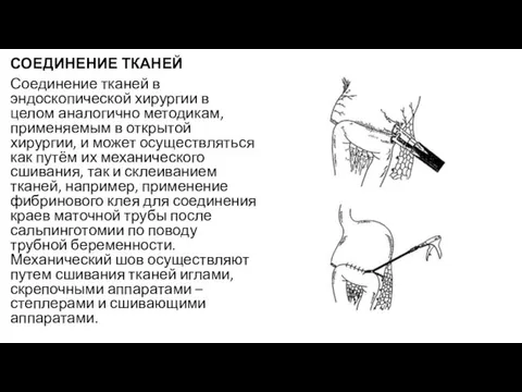 СОЕДИНЕНИЕ ТКАНЕЙ Соединение тканей в эндоскопической хирургии в целом аналогично методикам,