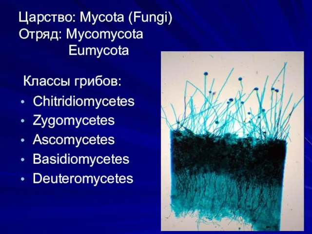 Царство: Mycota (Fungi) Отряд: Mycomycota Eumycota Классы грибов: Chitridiomycetes Zygomycetes Ascomycetes Basidiomycetes Deuteromycetes Домен: Эукариоты