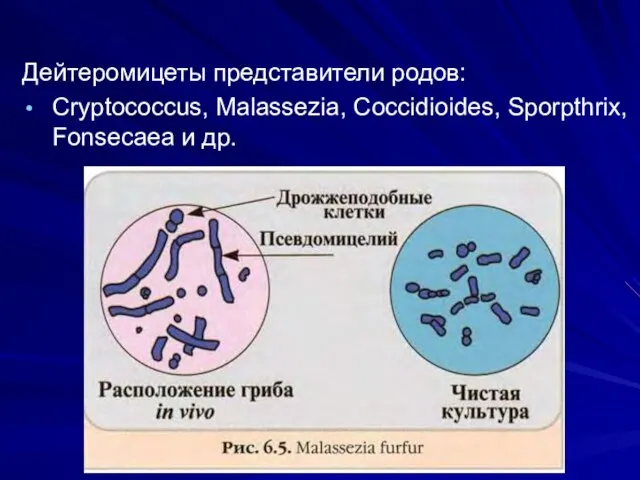 Дейтеромицеты представители родов: Cryptococcus, Malassezia, Coccidioides, Sporpthrix, Fonsecaea и др.