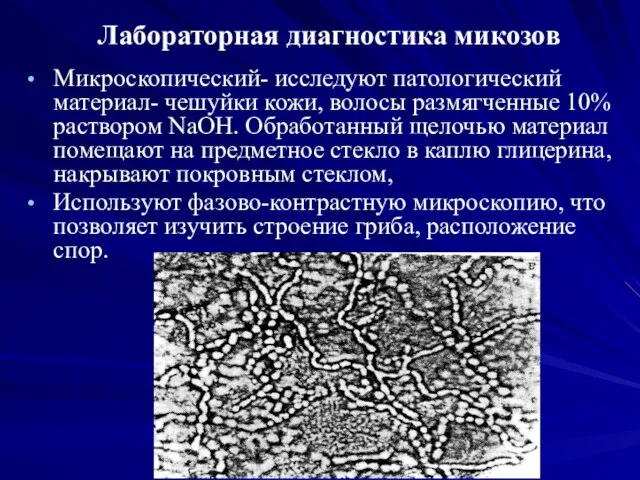 Лабораторная диагностика микозов Микроскопический- исследуют патологический материал- чешуйки кожи, волосы размягченные