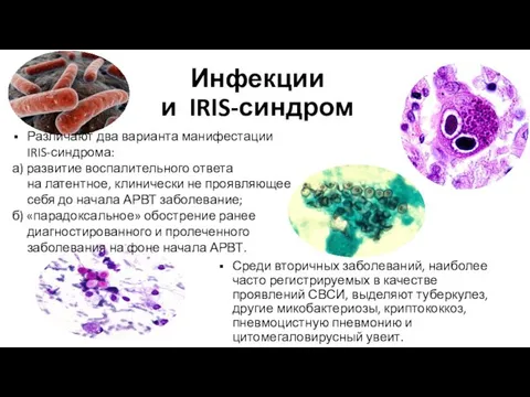 Инфекции и IRIS-синдром Среди вторичных заболеваний, наиболее часто регистрируемых в качестве