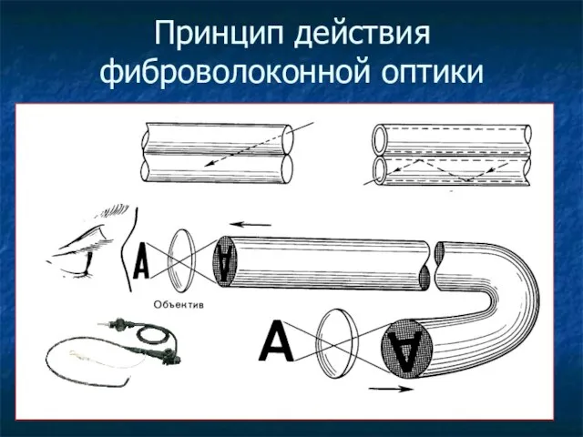 Принцип действия фиброволоконной оптики