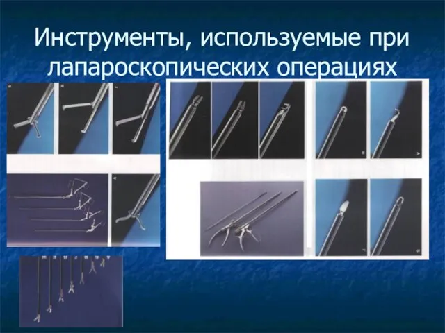 Инструменты, используемые при лапароскопических операциях