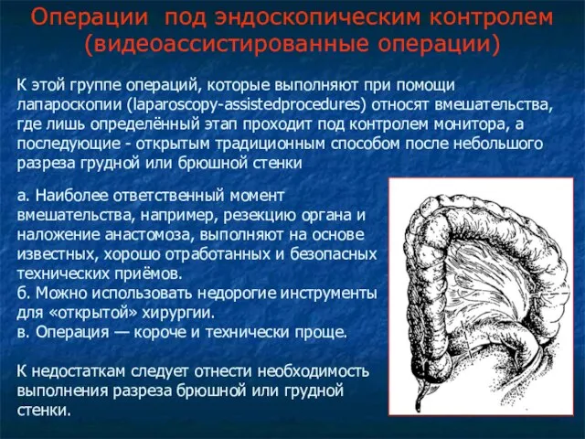 Операции под эндоскопическим контролем (видеоассистированные операции) К этой группе операций, которые