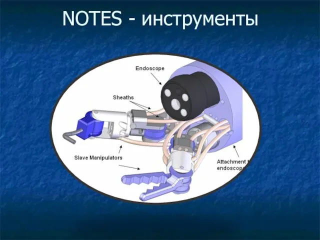 NOTES - инструменты