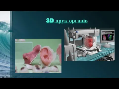 3D друк органів