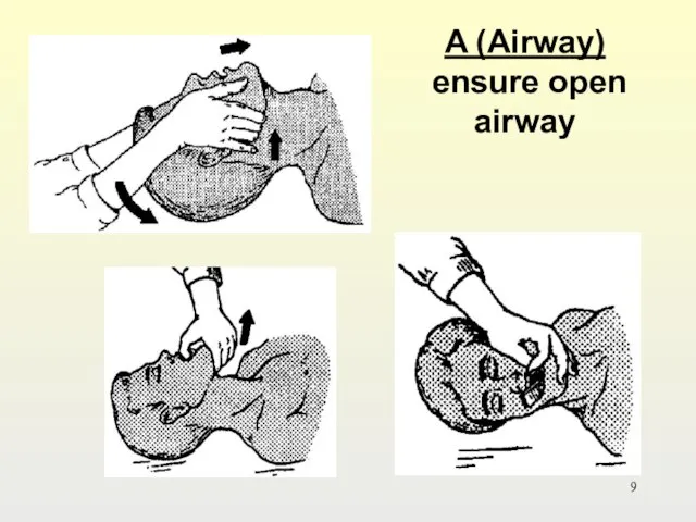 A (Airway) ensure open airway