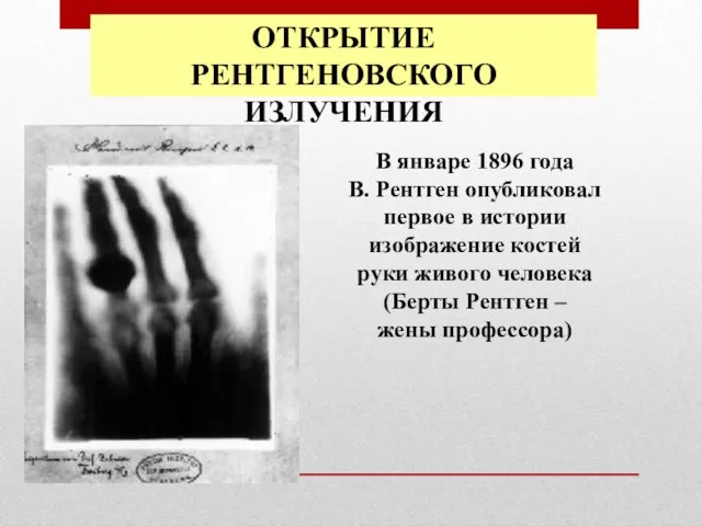 ОТКРЫТИЕ РЕНТГЕНОВСКОГО ИЗЛУЧЕНИЯ В январе 1896 года В. Рентген опубликовал первое