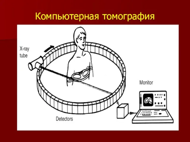 Компьютерная томография