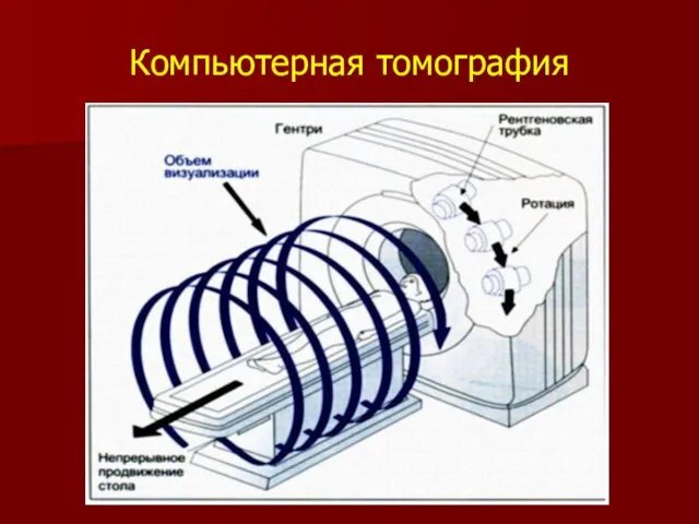 Компьютерная томография