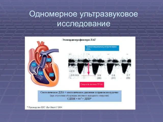 Одномерное ультразвуковое исследование