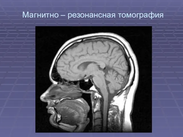 Магнитно – резонансная томография