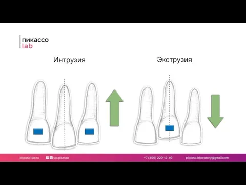 Интрузия Экструзия