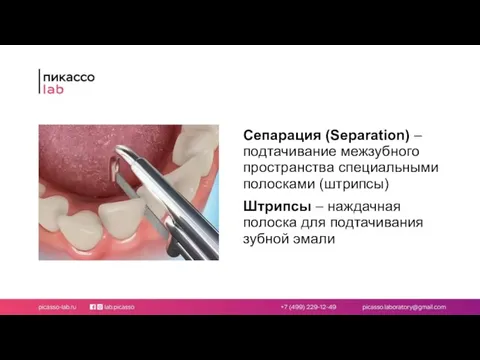 Сепарация (Separation) – подтачивание межзубного пространства специальными полосками (штрипсы) Штрипсы –