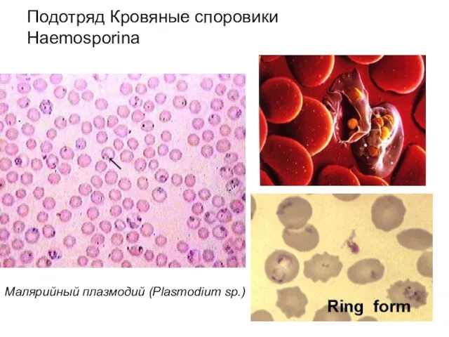 Подотряд Кровяные споровики Haemosporina Малярийный плазмодий (Plasmodium sp.)