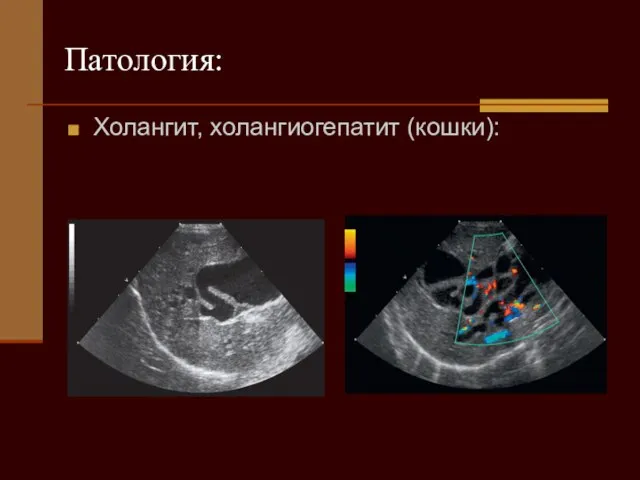 Патология: Холангит, холангиогепатит (кошки):