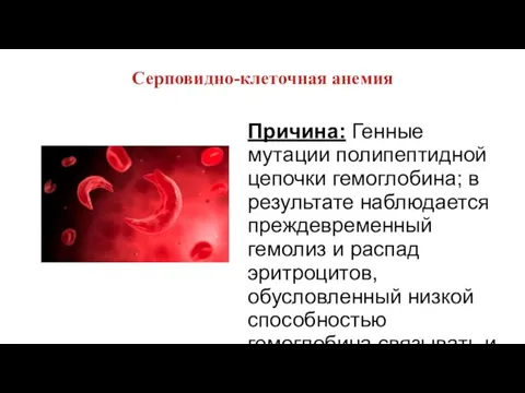 Серповидно-клеточная анемия Причина: Генные мутации полипептидной цепочки гемоглобина; в результате наблюдается