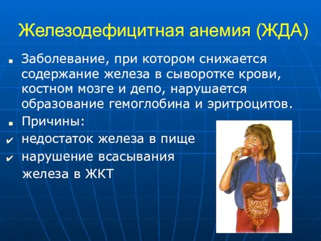 Железодефицитная анемия (ЖДА) Заболевание, при котором снижается содержание железа в сыворотке