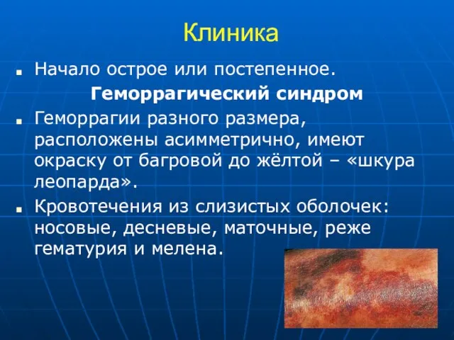 Клиника Начало острое или постепенное. Геморрагический синдром Геморрагии разного размера, расположены