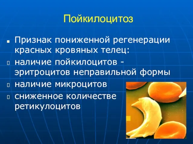 Пойкилоцитоз Признак пониженной регенерации красных кровяных телец: наличие пойкилоцитов - эритроцитов